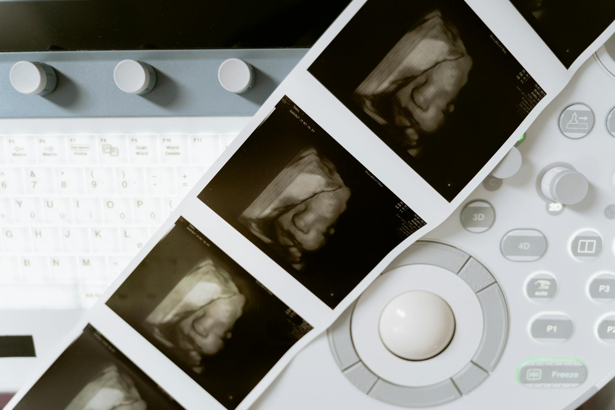 Close-up of a 3D ultrasound scan printout and medical equipment in a health lab.