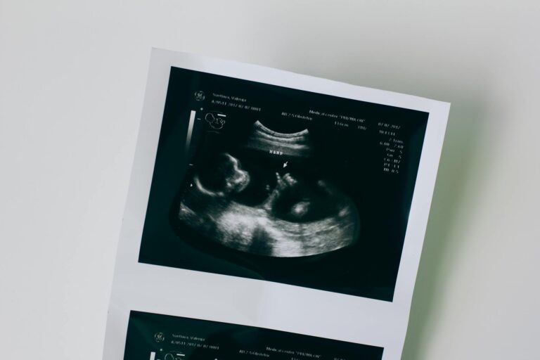 Detailed close-up of a pregnancy ultrasound showing developing fetus.